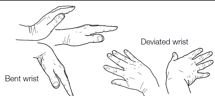 ART C4 wrist posture illustration